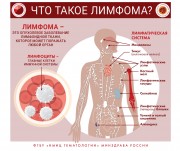 Инфографика по вопросам заболеваемости системы крови